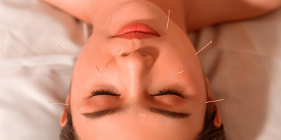 Curso de Acupuntura Estética