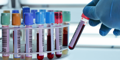 Curso de Interpretación de Análisis de Sangre Paso a Paso