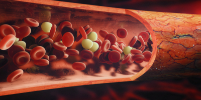 Curso en Factores de Riesgo Cardiovascular