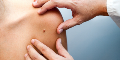 Curso en Dermatología para Enfermería