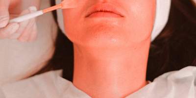 Especialista en Mesoterapia Facial