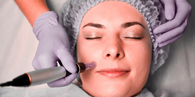 Curso en Mesoterapia Facial