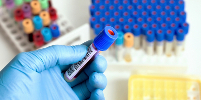 Especialista en Nanotecnología Farmacéutica