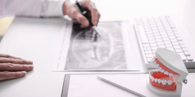 Curso Online de Operador Rayos X de Diagnóstico Dental