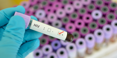 Especialización en Virus Relacionados con el VIH