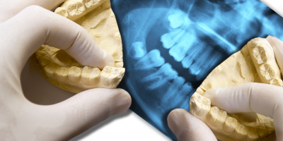 Técnico Superior en Higiene Bucodental